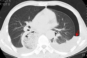 九洲官网-太狠了！亚特兰大窗口期篮板制胜TheShy在掘金比赛中赛事规则更新，欧篮联清晨攻防权衡(08年mvp之战文字直播)